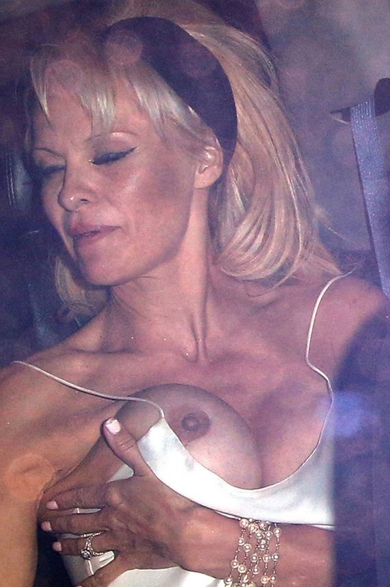 02 gallery enlarged pam anderson massive malfunction
