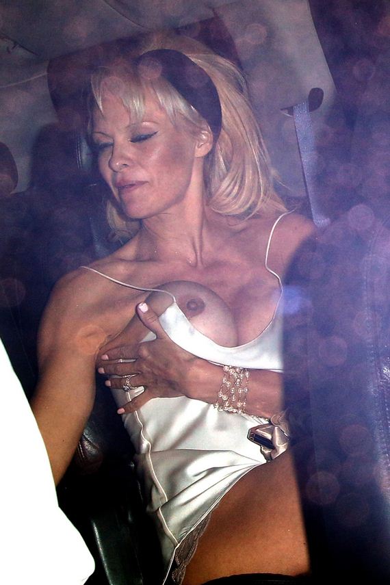 04 gallery enlarged pam anderson massive malfunction