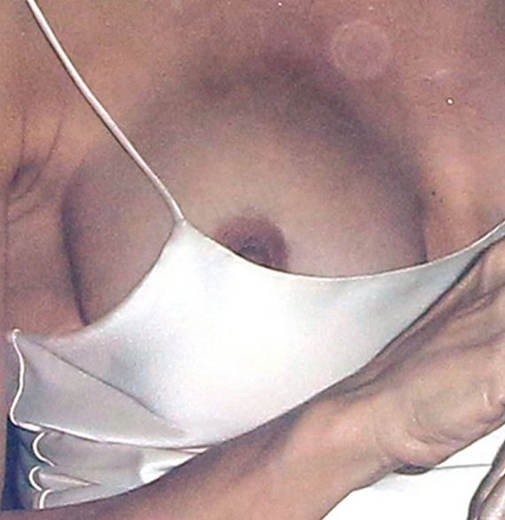 10 gallery enlarged pam anderson massive malfunction