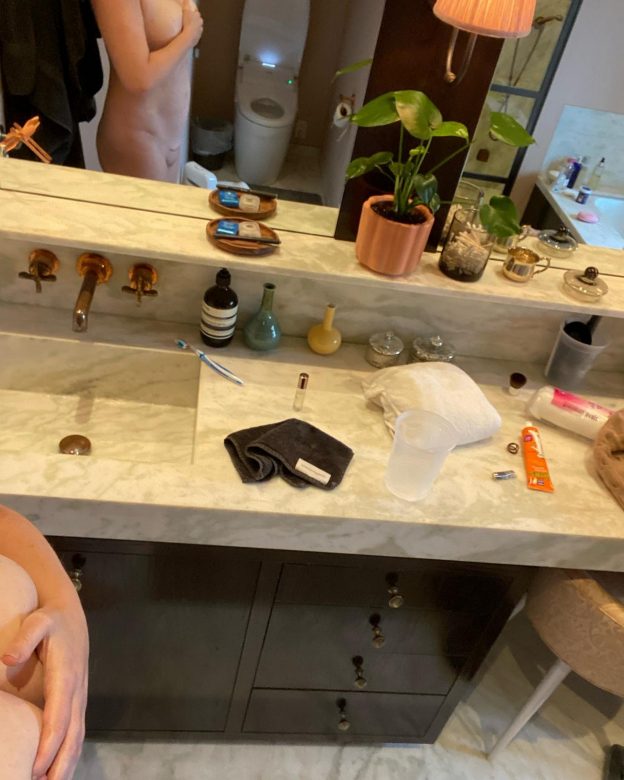 Amy Schumer After Liposuction TheFappening.Pro 3 624x780 1