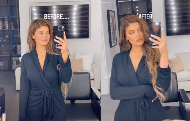 Kylie Jenner Before And After Makeup 624x396 1