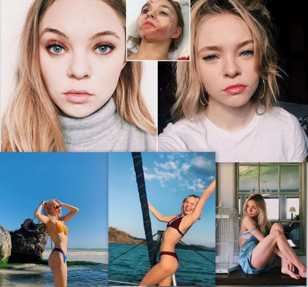Taylor Hickson Nude Sexy Collection 624x580 1