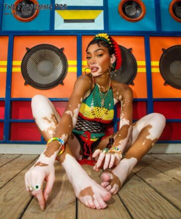 Winnie Harlow Feet TheFappening.Pro 9 624x755 1