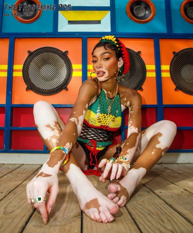Winnie Harlow Sexy In Hawaii (9 Photos) 9 Winnie Harlow Feet TheFappening.Pro 9 624x755 1