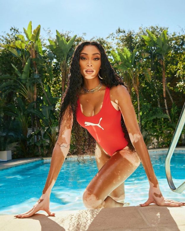 Winnie Harlow In Puma Swimsuit (14 Photos) 15 Winnie Harlow Sexy Bikini TheFappening.Pro 2 624x780 1