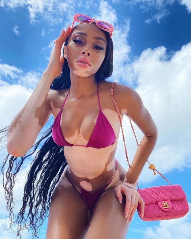 Winnie Harlow Sexy Bikini TheFappening.Pro 4 624x780 1