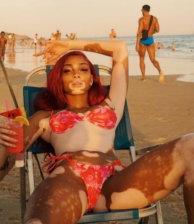 Winnie Harlow Sexy Bikini TheFappening.pro 11 624x722 1