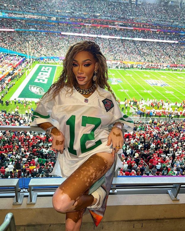 Winnie Harlow Sexy At Super Bowl 2023 (3 Photos) 13 Winnie Harlow Sexy TheFappening.Pro 1 624x780 1