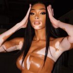Winnie Harlow Sexy TheFappening.Pro 2 624x755 1