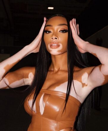Winnie Harlow Sexy In Versace (7 Photos And Video) 21 Winnie Harlow Sexy TheFappening.Pro 2 624x755 1