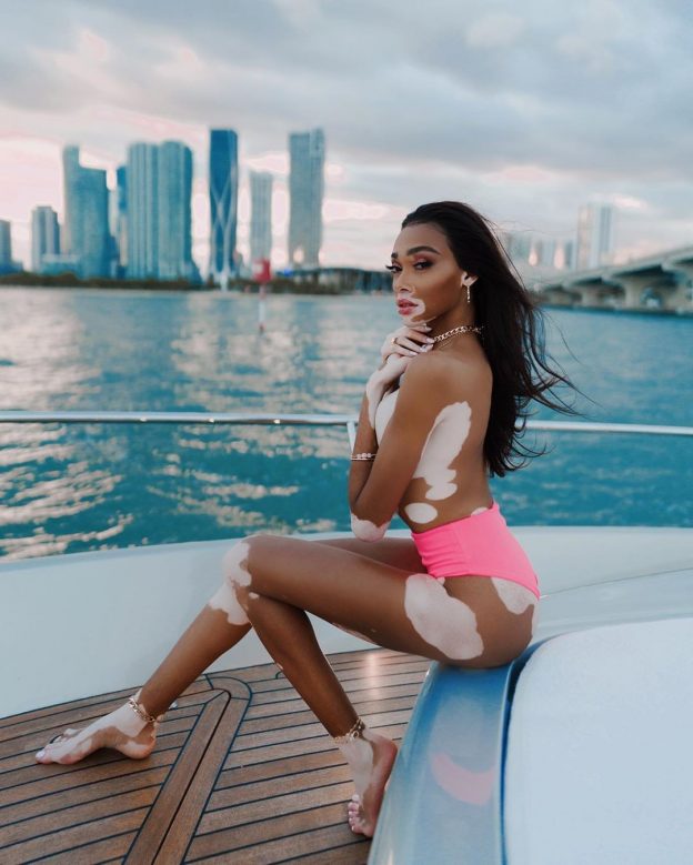 Winnie Harlow Topless And Sexy Bikini (10 Photos and Video) 4 Winnie Harlow Topless Sexy 3 624x779 1