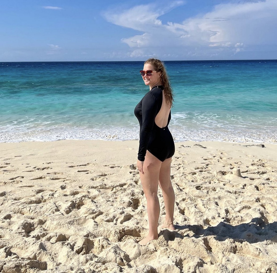 amy-schumer-after-liposuction-thefappening-cfd-2 Amy Schumer Bikini After Liposuction