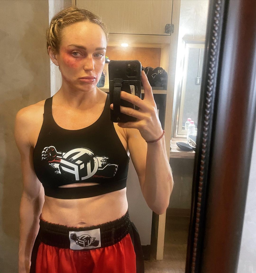 caity-lotz-pretty-on-leaked-selfies-thefappening-cfd-13 caity lotz pretty on leaked selfies thefappening cfd 13