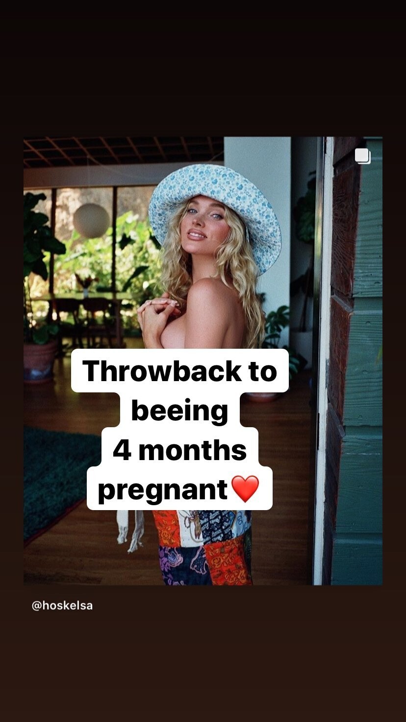 elsa-hosk-topless-4-month-pregnant-thefappeningpro-1 elsa hosk topless 4 month pregnant thefappeningpro 1
