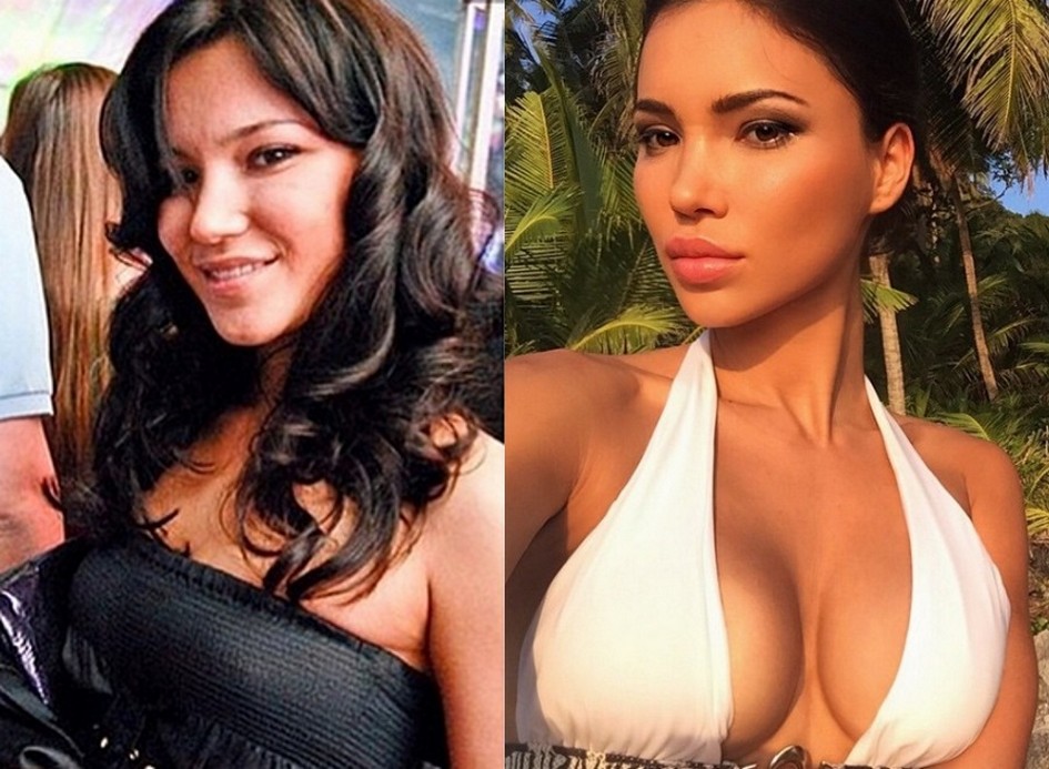 sveta-bilyalova-thefappening-cfd-2 Sveta Bilyalova's Tits Before Plastic Surgery