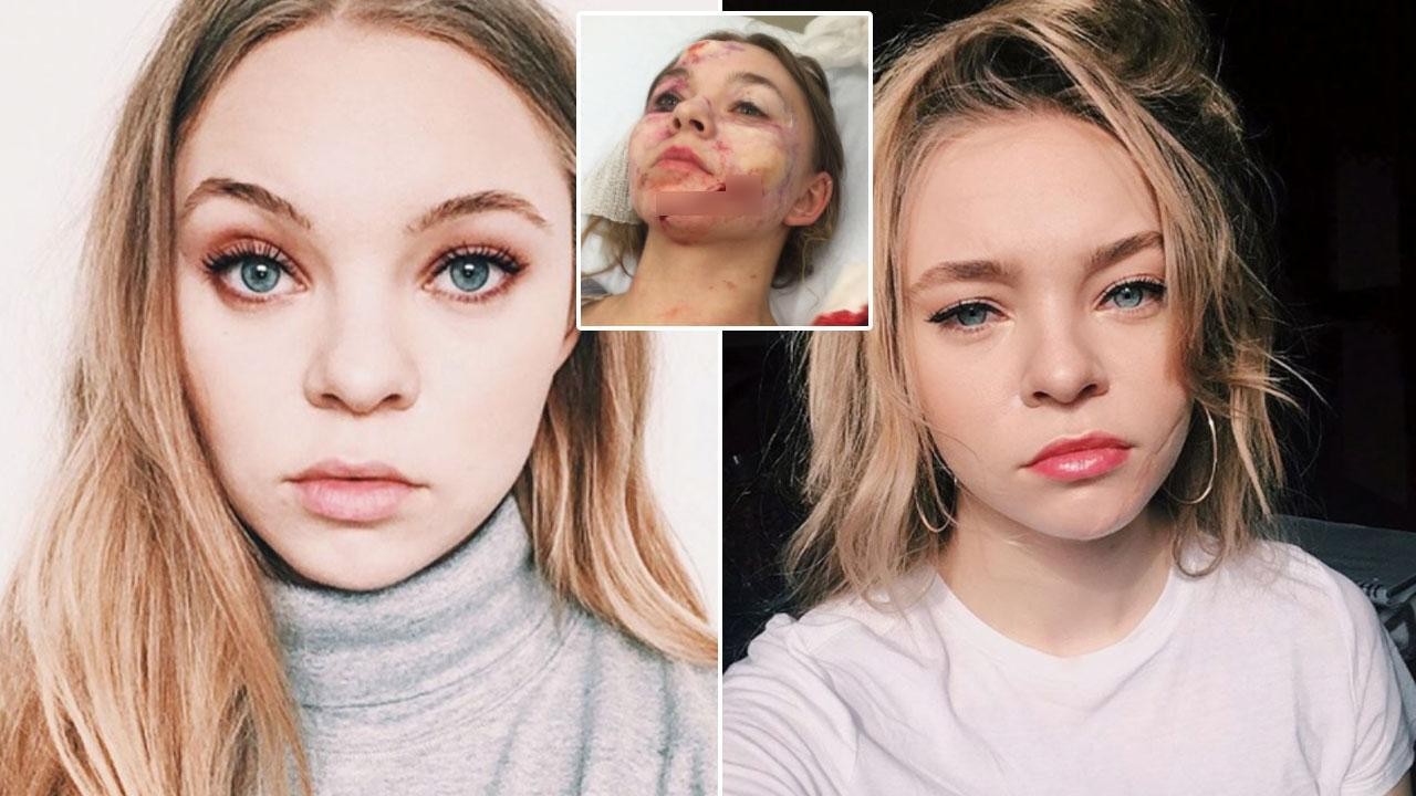 taylor-hickson-and-her-terrible-scar-thefappening-pro-1 taylor hickson and her terrible scar thefappening pro 1