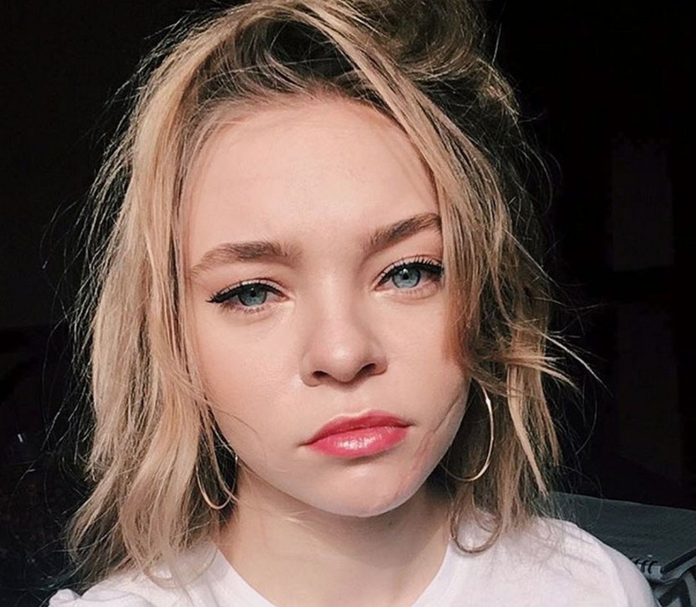 taylor-hickson-and-her-terrible-scar-thefappening-pro-11 taylor hickson and her terrible scar thefappening pro 11