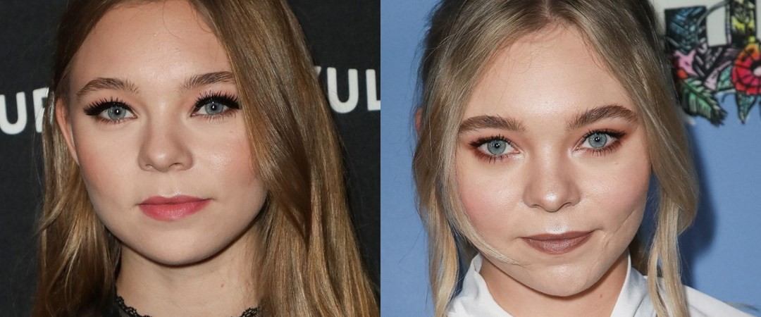 taylor-hickson-and-her-terrible-scar-thefappening-pro-13 taylor hickson and her terrible scar thefappening pro 13