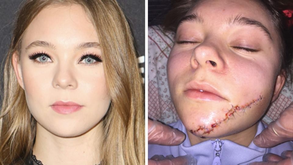 taylor-hickson-and-her-terrible-scar-thefappening-pro-4 taylor hickson and her terrible scar thefappening pro 4