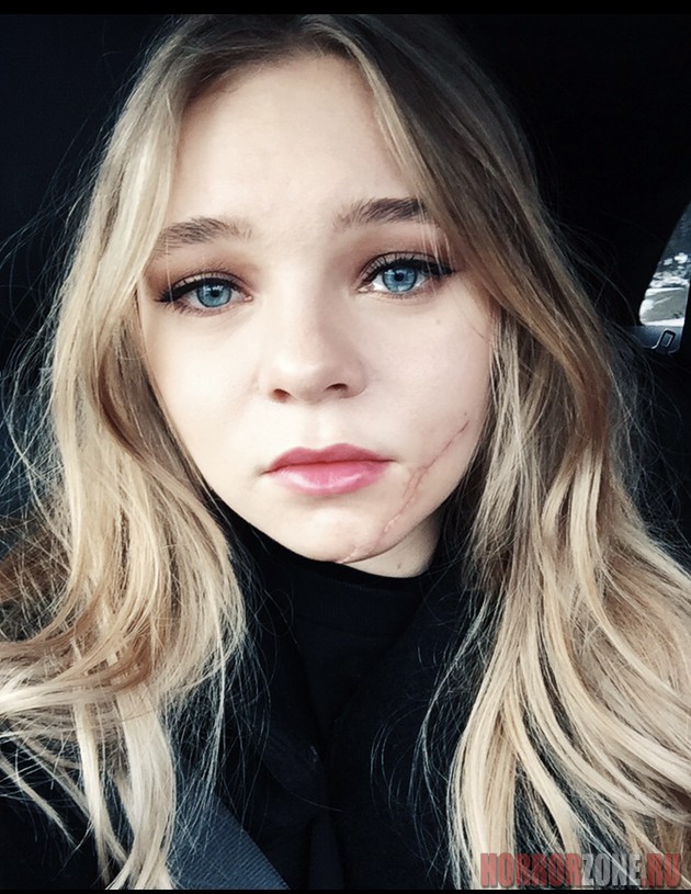 taylor-hickson-and-her-terrible-scar-thefappening-pro-9 taylor hickson and her terrible scar thefappening pro 9