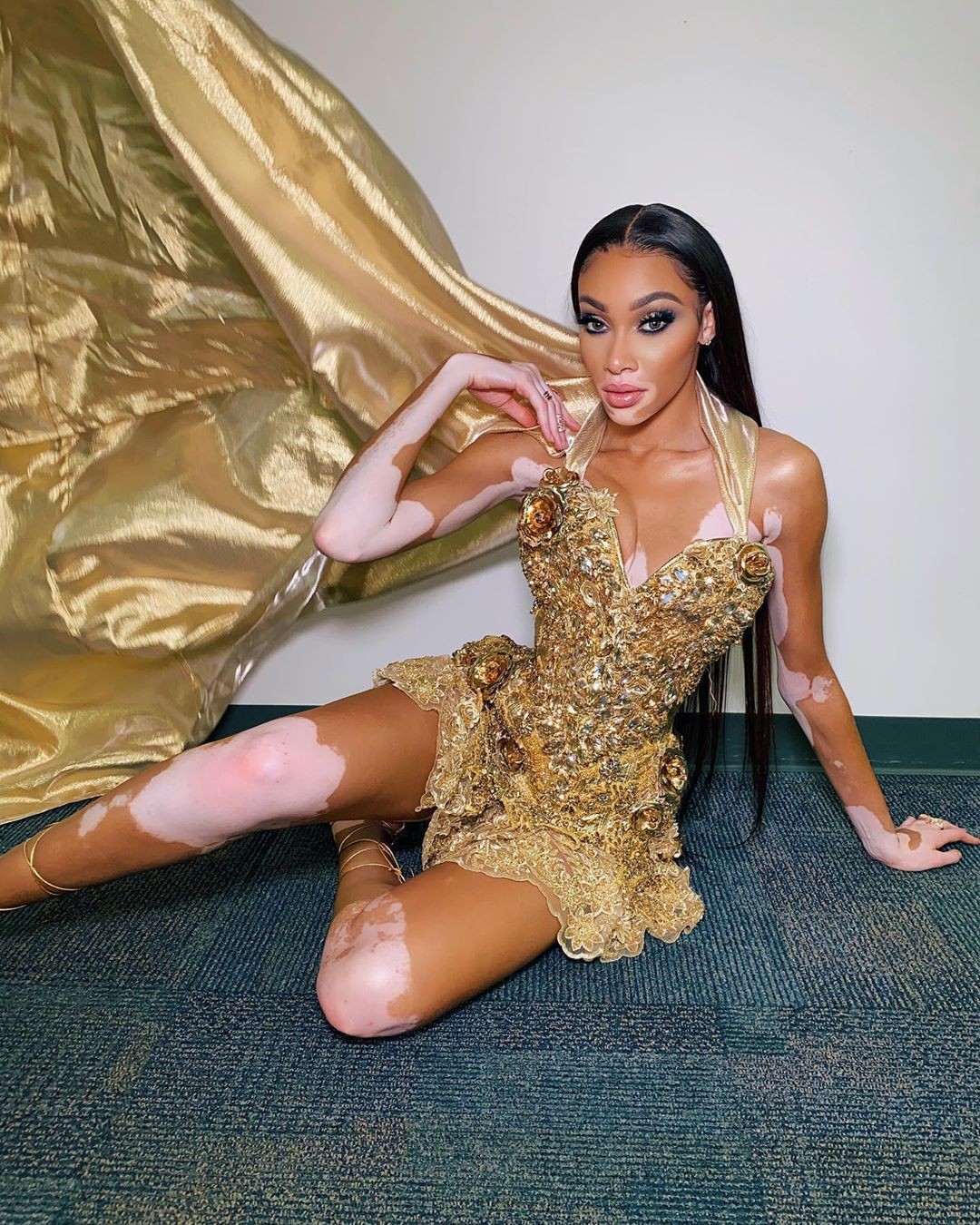 winnie-harlow-baby-in-a-million-thefappening-pro-1 winnie harlow baby in a million thefappening pro 1