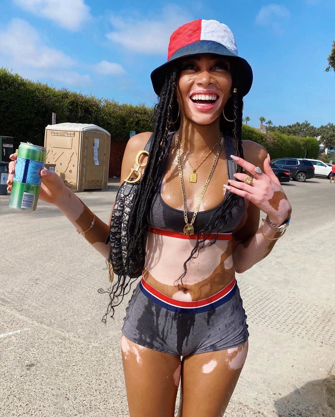 winnie-harlow-baby-in-a-million-thefappening-pro-11 winnie harlow baby in a million thefappening pro 11