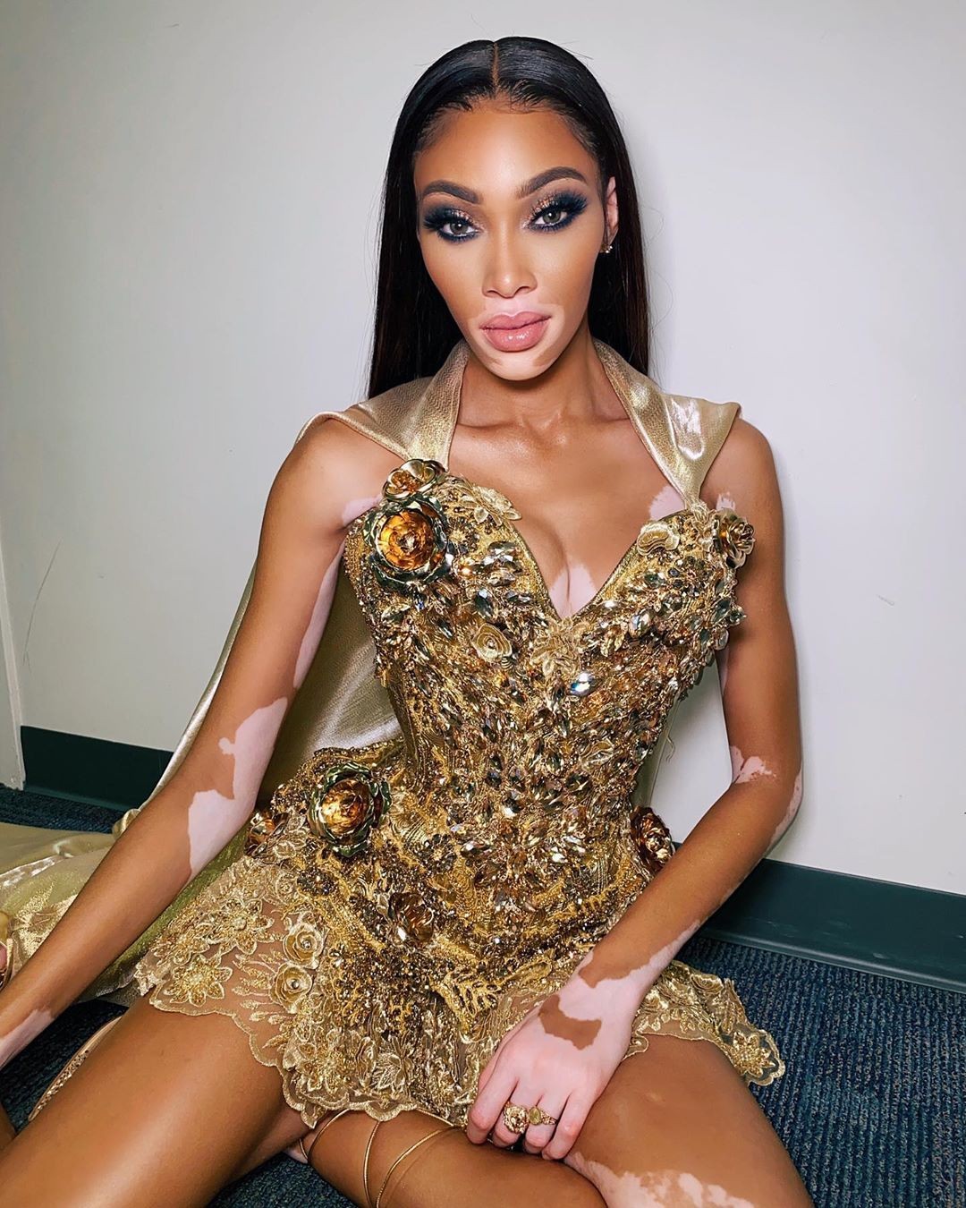 winnie-harlow-baby-in-a-million-thefappening-pro-16 winnie harlow baby in a million thefappening pro 16