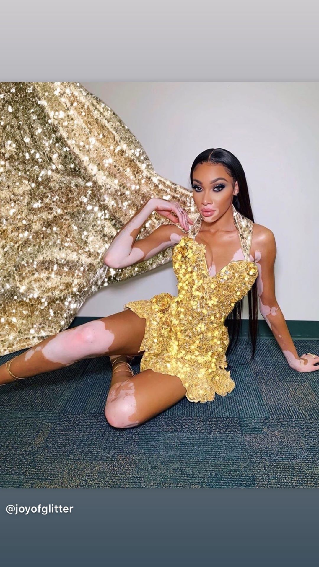 winnie-harlow-baby-in-a-million-thefappening-pro-17 Winnie Harlow Baby In A Million