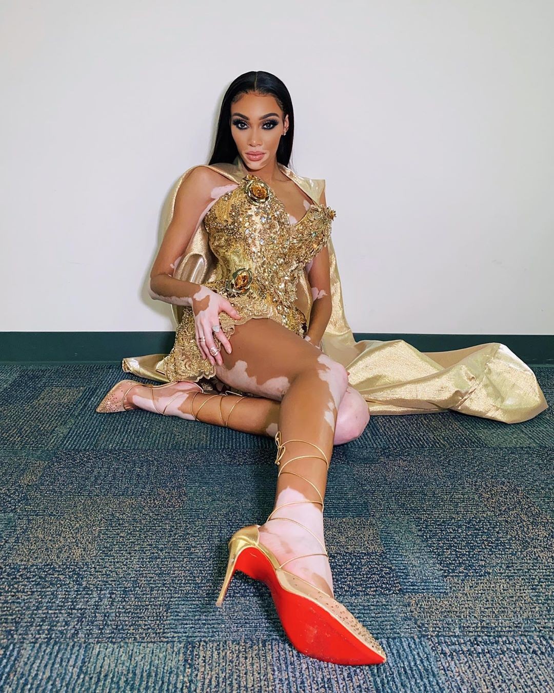 winnie-harlow-baby-in-a-million-thefappening-pro-18 winnie harlow baby in a million thefappening pro 18
