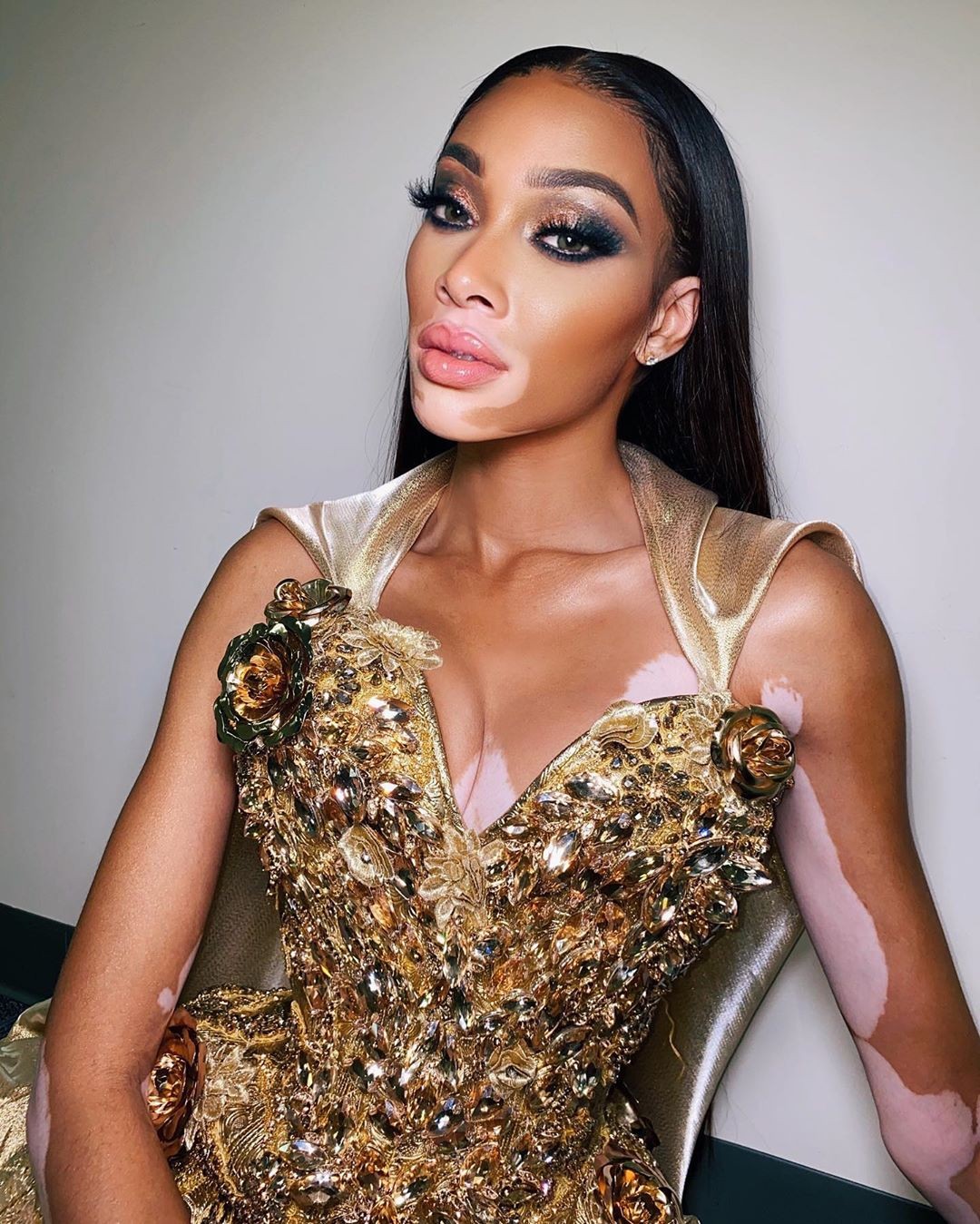 winnie-harlow-baby-in-a-million-thefappening-pro-19 winnie harlow baby in a million thefappening pro 19