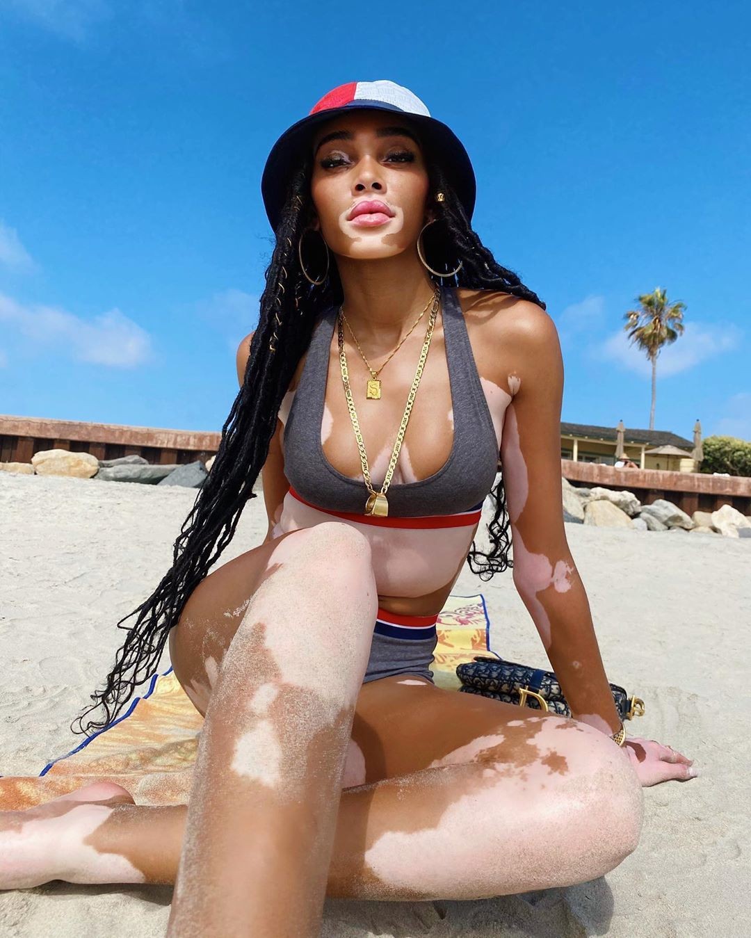 winnie-harlow-baby-in-a-million-thefappening-pro-3 winnie harlow baby in a million thefappening pro 3