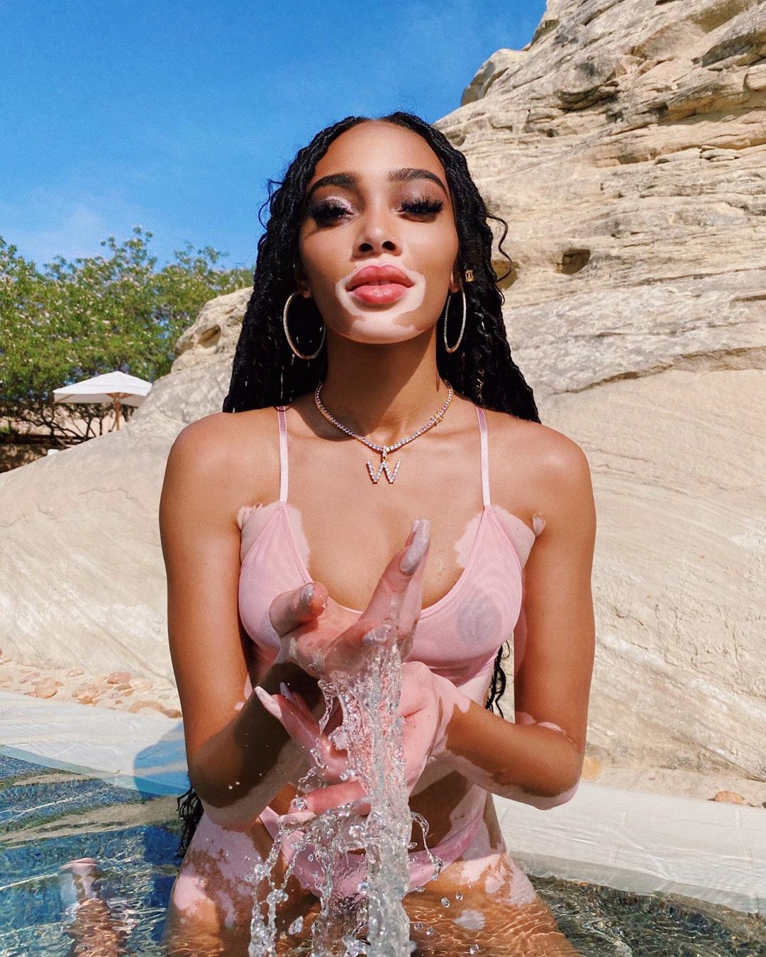 winnie-harlow-baby-in-a-million-thefappening-pro-7 winnie harlow baby in a million thefappening pro 7