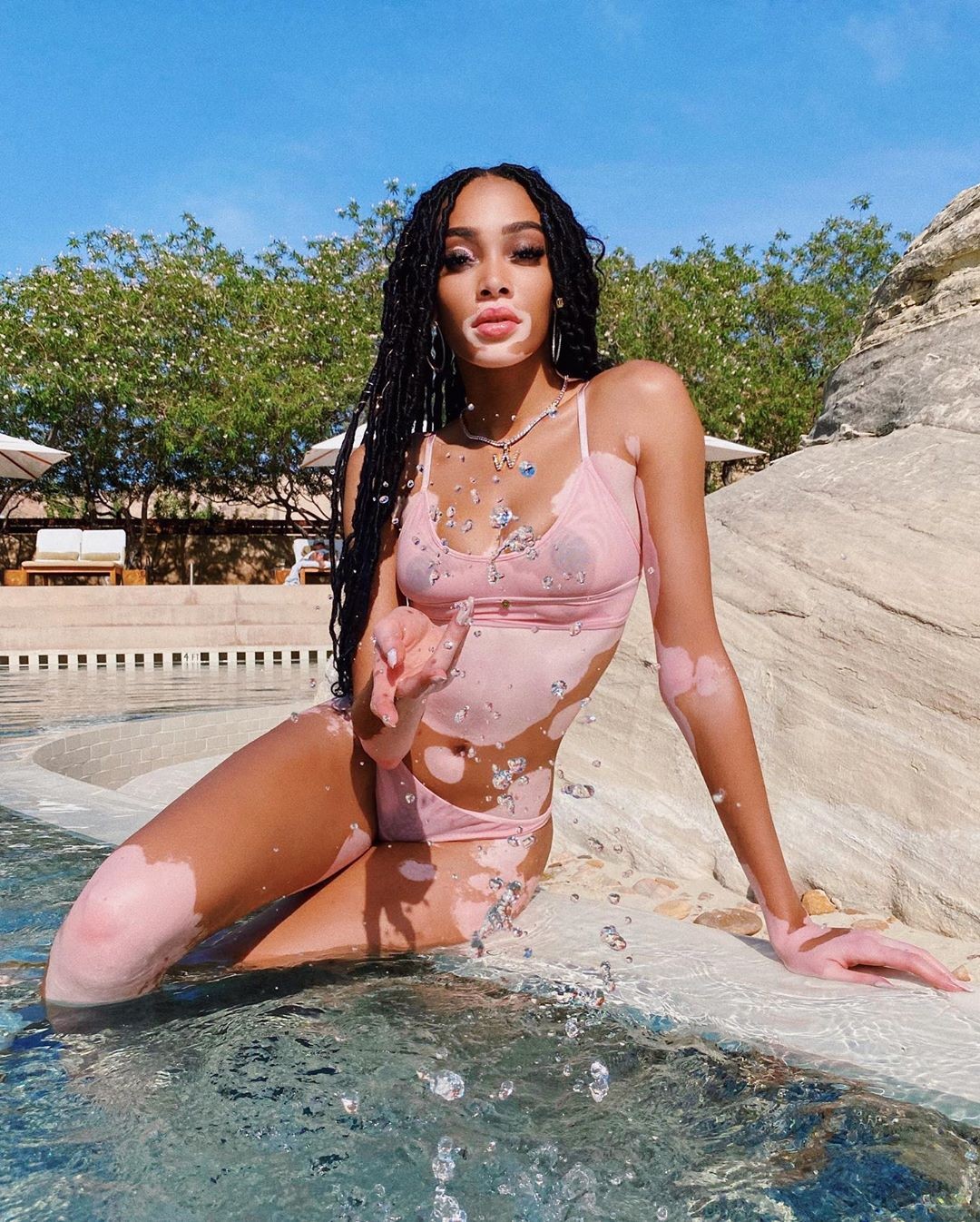 winnie-harlow-baby-in-a-million-thefappening-pro-8-1 winnie harlow baby in a million thefappening pro 8 1