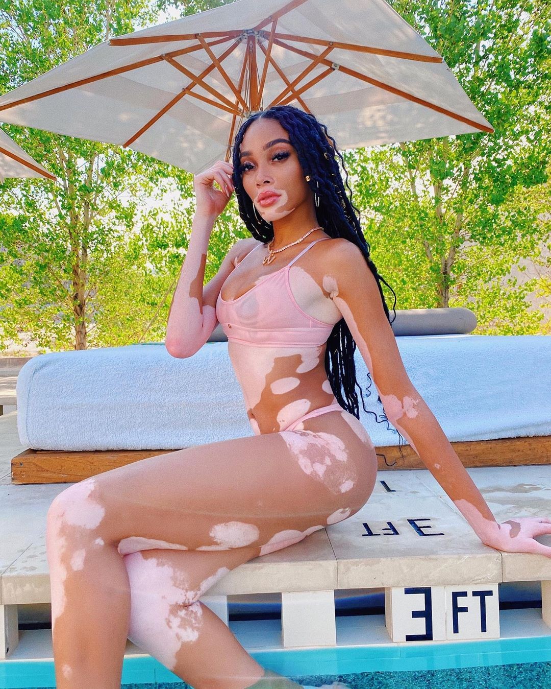 winnie-harlow-baby-in-a-million-thefappening-pro-9 winnie harlow baby in a million thefappening pro 9