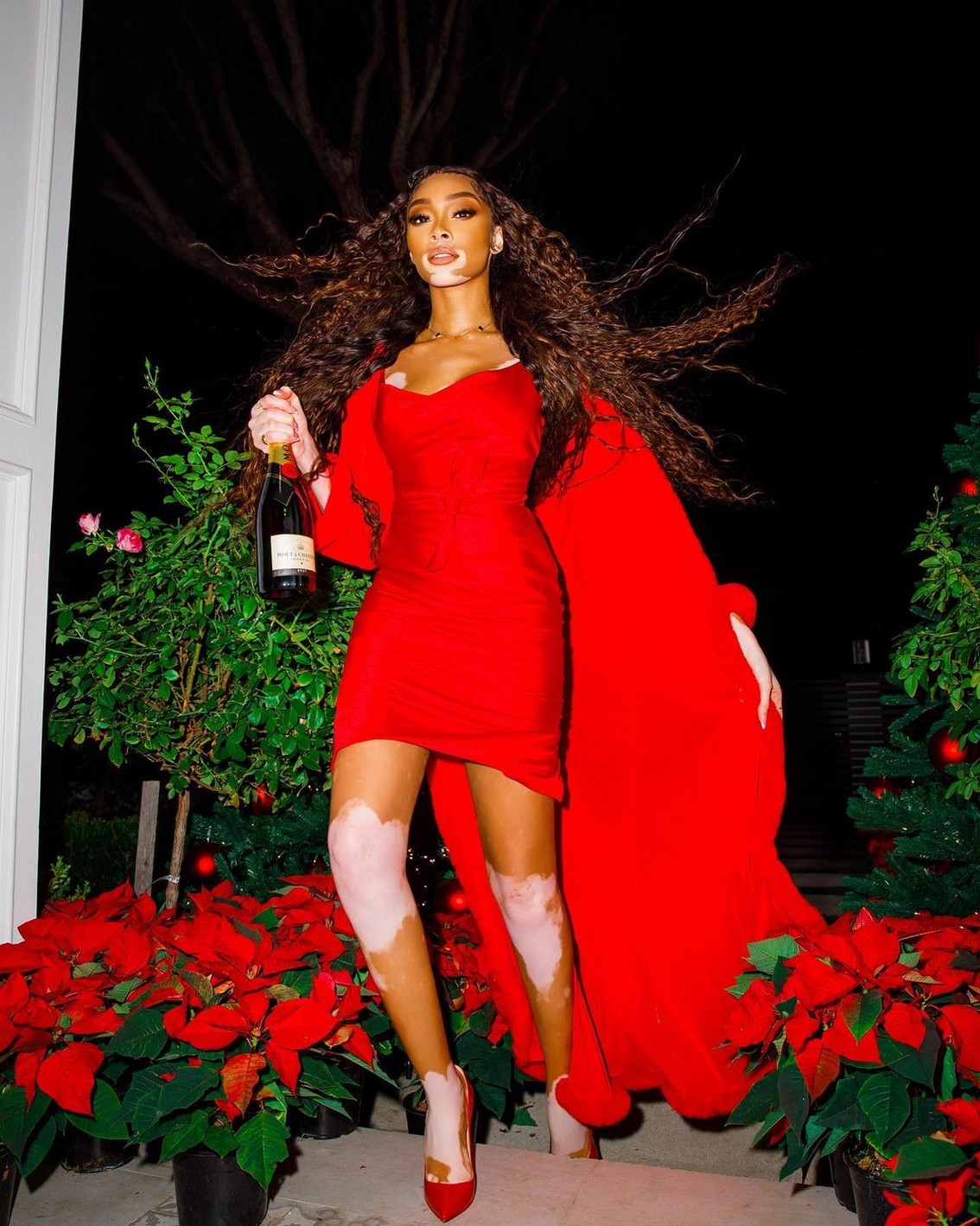 winnie-harlow-barefoot-christmas-thefappening-cfd-4 winnie harlow barefoot christmas thefappening cfd 4