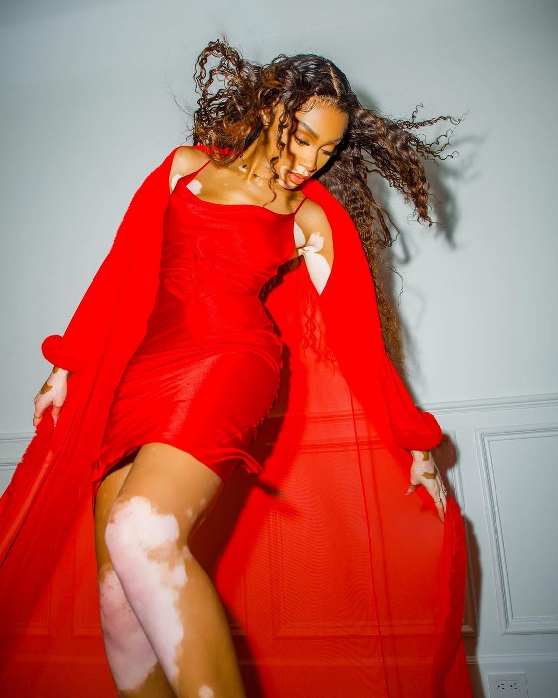 winnie-harlow-barefoot-christmas-thefappening-cfd-6 Winnie Harlow Fappening