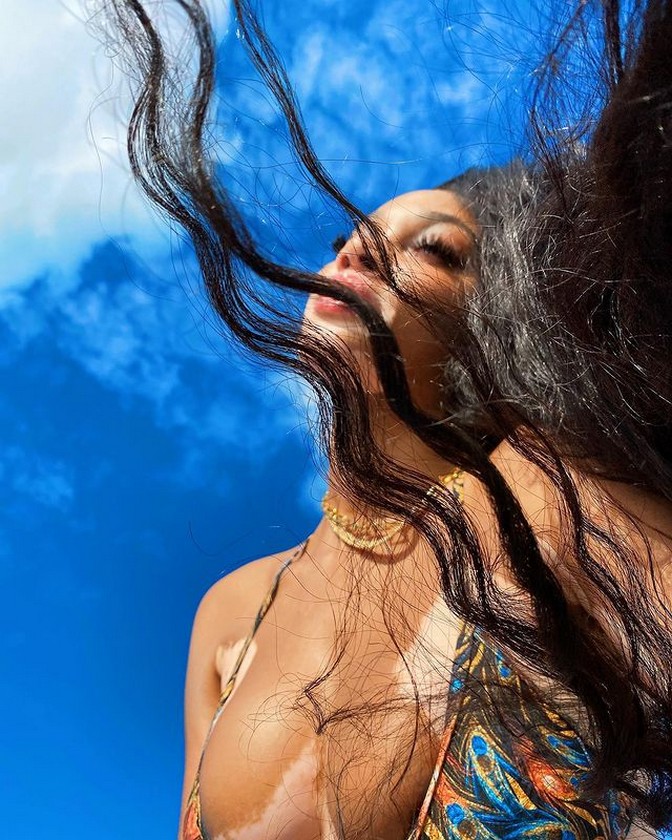 winnie-harlow-bikini-thefappening-cfd-21 winnie harlow bikini thefappening cfd 21