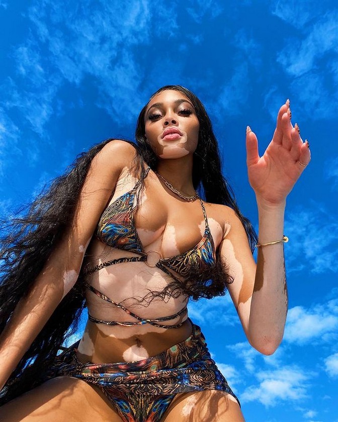 winnie-harlow-bikini-thefappening-cfd-4 winnie harlow bikini thefappening cfd 4