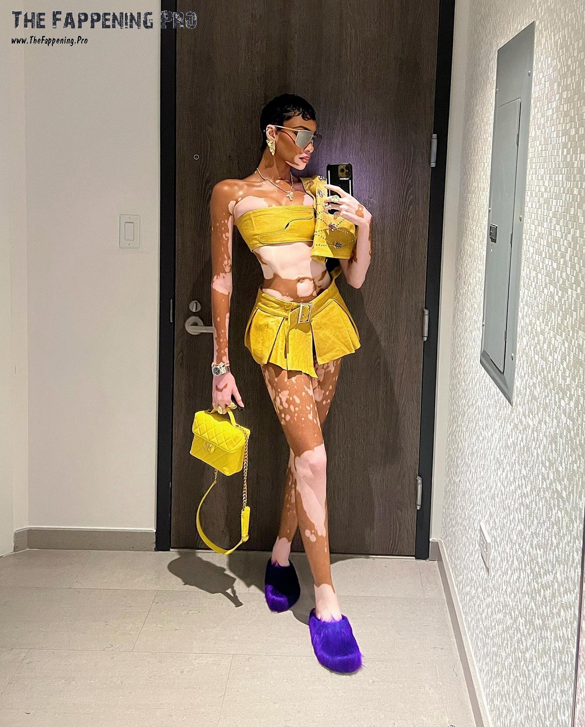 winnie-harlow-feet-thefappening-cfd-1 Winnie Harlow Leggy