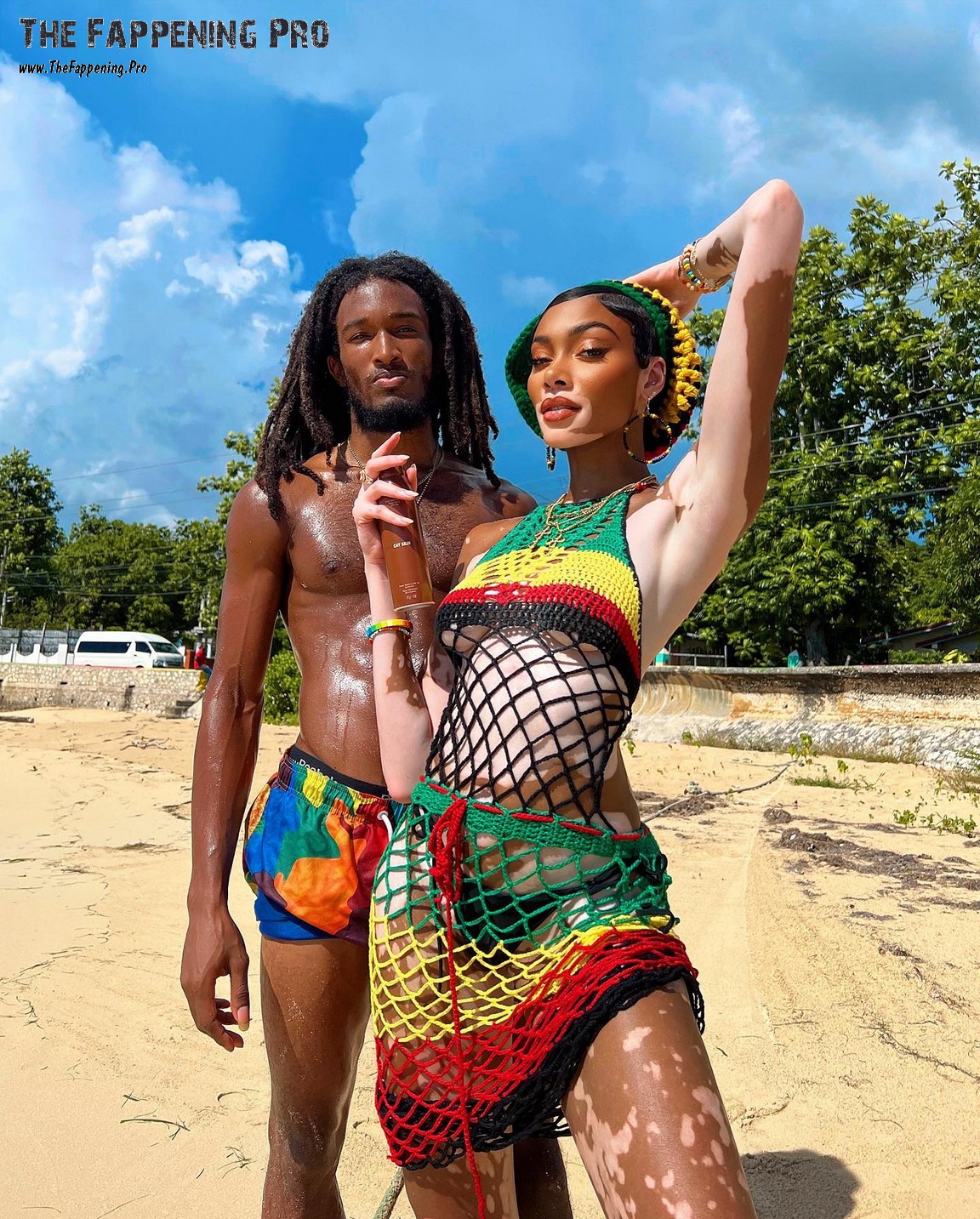 winnie-harlow-feet-thefappening-cfd-4 winnie harlow feet thefappening cfd 4