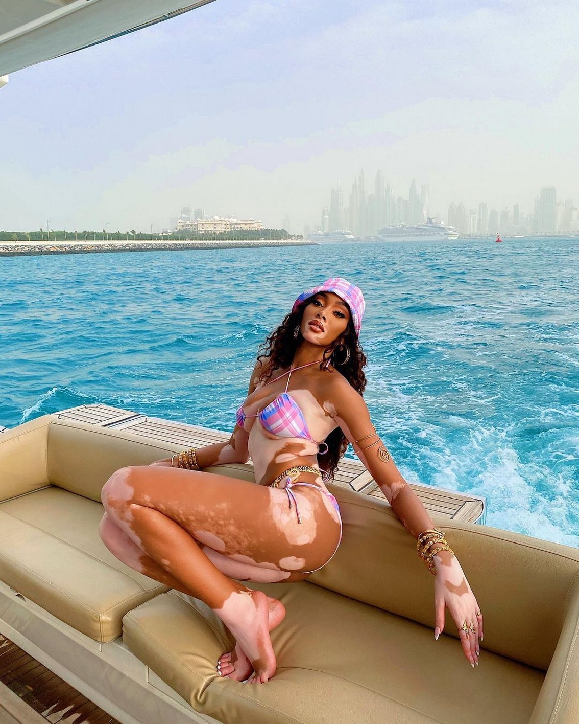 winnie-harlow-new-year-bikini-thefappening-cfd-6-1 Winnie Harlow Barefeet