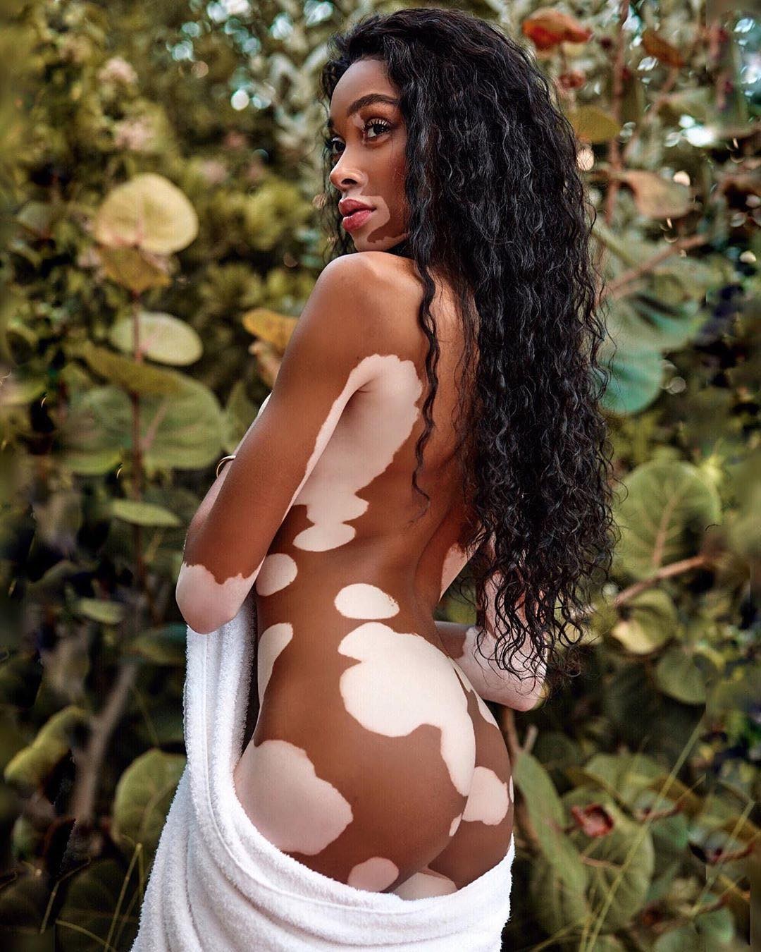 winnie-harlow-nude-1 winnie harlow nude 1