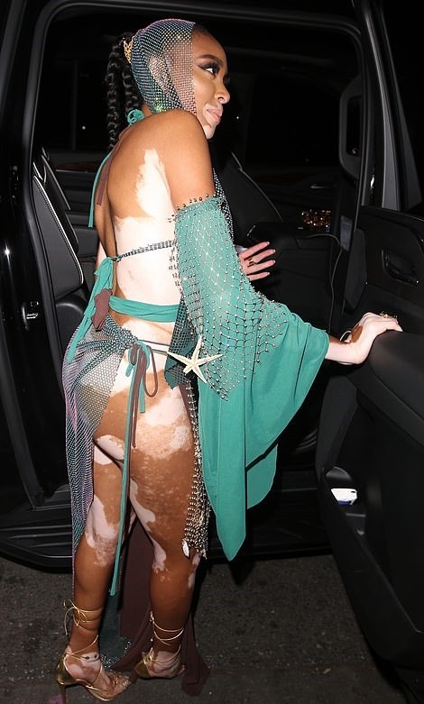 winnie-harlow-see-through-thefappening-cfd-11 Winnie Harlow Ass