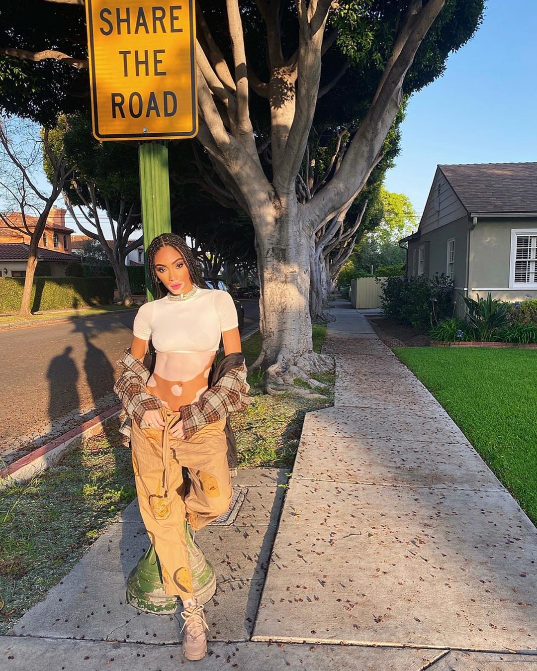 winnie-harlow-sexy-after-self-isolation-thefappening-pro-2 winnie harlow sexy after self isolation thefappening pro 2
