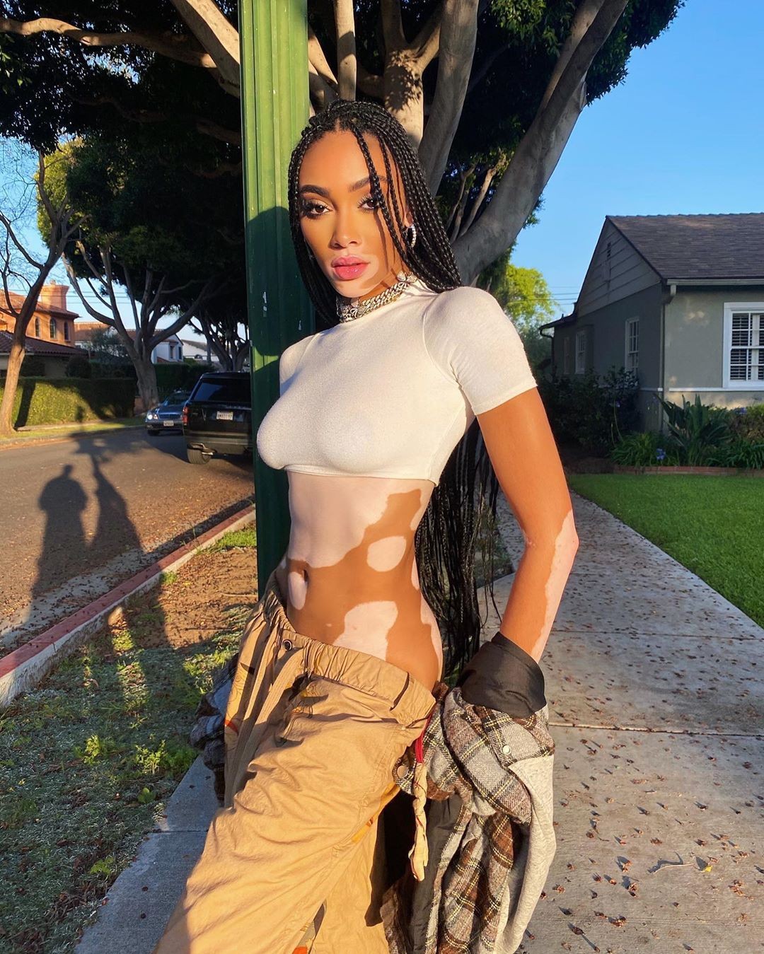 winnie-harlow-sexy-after-self-isolation-thefappening-pro-3 winnie harlow sexy after self isolation thefappening pro 3