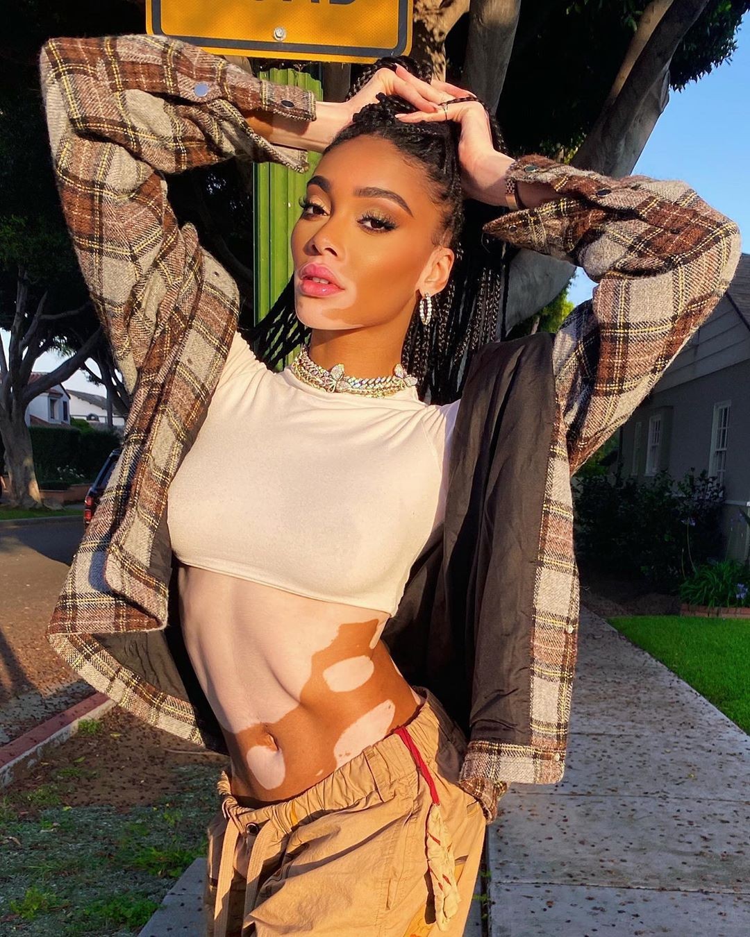 winnie-harlow-sexy-after-self-isolation-thefappening-pro-4 winnie harlow sexy after self isolation thefappening pro 4