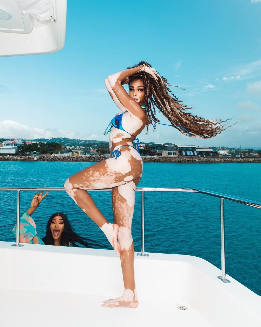 winnie-harlow-sexy-bikini-thefappening-cfd-12 Winnie Harlow Barefeet
