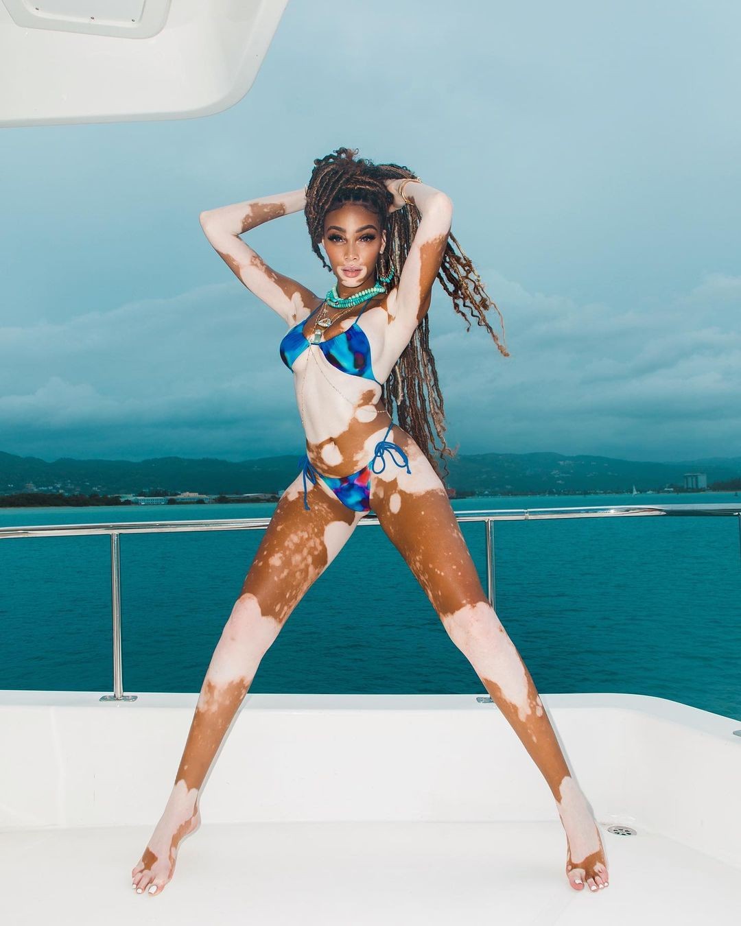 winnie-harlow-sexy-bikini-thefappening-cfd-14 Winnie Harlow Fappening