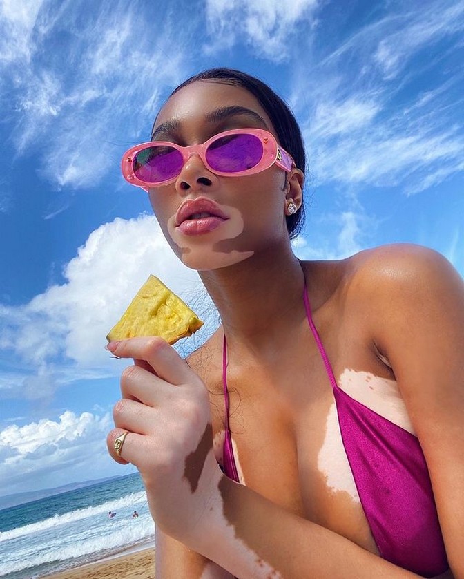 winnie-harlow-sexy-bikini-thefappening-cfd-2 winnie harlow sexy bikini thefappening cfd 2
