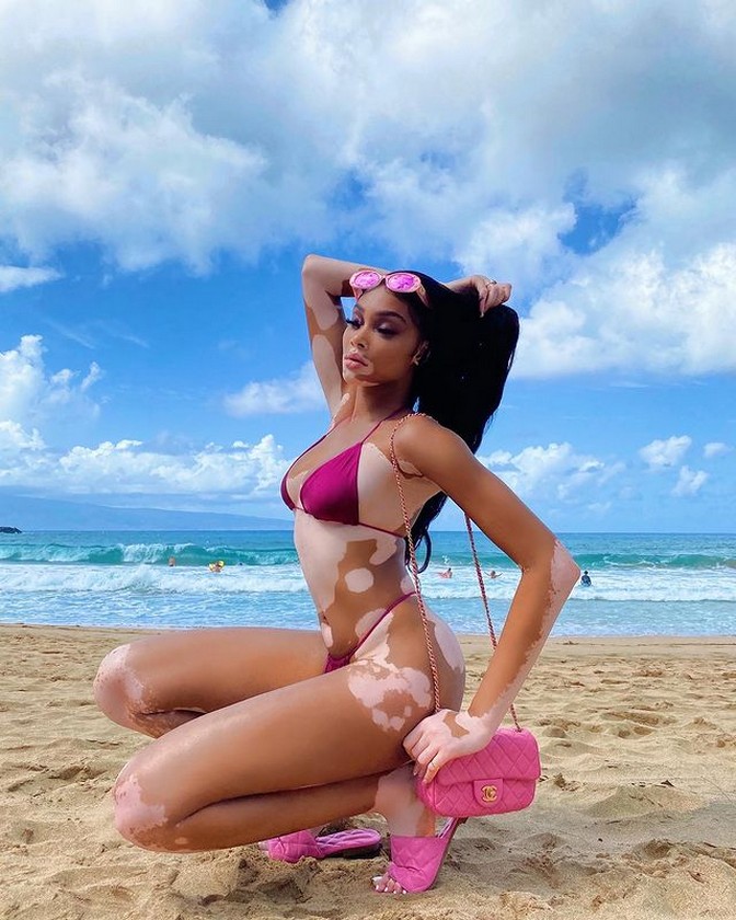 winnie-harlow-sexy-bikini-thefappening-cfd-3 Winnie Harlow Sexy